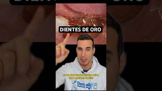 DIENTES de ORO  ¿Tienes o conoces a alguien con alguno ¿Se siguen utilizando [upl. by Kingston]