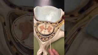 Spinal Cord Meninges close up with Dr Masi [upl. by Anileve]