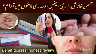 Travocort cream uses  benefits honest review by Maha jutt [upl. by Augie979]