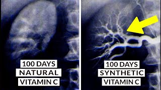 We Finally Know What Type Of Vitamin C Is Best [upl. by Lemyt]