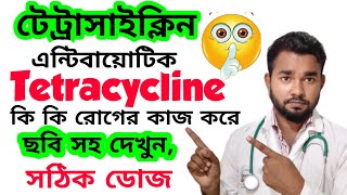 Tetracycline Antibiotics কি কাজ করেটেট্রাসাইক্লিন খাওয়ার নিয়মটেট্রাসাইক্লিন ঔষধcpdrubelmia5966 [upl. by Goodard]