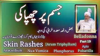 Skin rashes Jism pr shapaqi Belladonna  Arum triphyllum  Anacardium Nux vomica  pulsatilla [upl. by Paehpos]