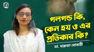 গলগন্ড কি কেন হয় প্রতিকার কি goitre গলগন্ড [upl. by Marty]