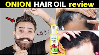 MAMAEARTH ONION HAIR OIL REVIEW  AFTER 1MONTH OF USE  QUALITYMANTRA [upl. by Mollie]