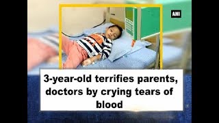 3yearold terrifies parents doctors by crying tears of blood  Telangana News [upl. by Kaitlin]