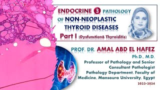 Thyroid dysfunction and thyroiditis  lecture شرح محاضرة [upl. by Atinor]