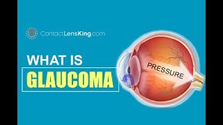 What is Glaucoma and Intraocular Pressure [upl. by Vincentia530]