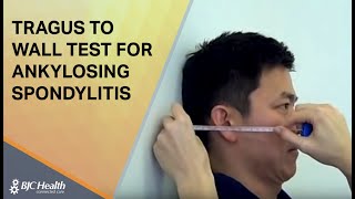 Tragus to Wall test for Ankylosing Spondylitis [upl. by Eleen]