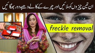 Eid Face Freckle Removal Remedy at Home  Dark Spots  Pigmentation Face Freckles Treatment at home [upl. by Armillas]