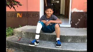 Prosthetic Clinic at Hospital Shalom Peten Guatemala August 2018 [upl. by Ynohtna518]