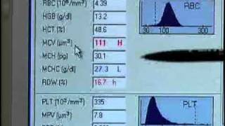 How to Use a Blood Analyser  William Armour [upl. by Wadesworth]