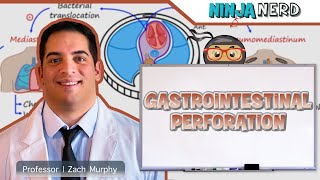 Gastrointestinal Perforation  Clinical Medicine [upl. by Crispa49]