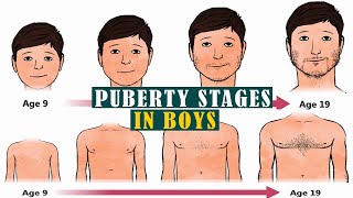 Puberty for boys stages 5 Things to Expect When Puberty Hits Boys [upl. by Josler660]