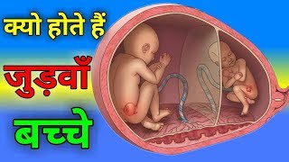 जुड़वाँ बच्चे क्यो होते हैं  Twins Baby Pregnancy Symptoms In Hindi  Conceiving twins  Pink Glow [upl. by Charleton]