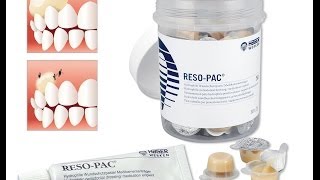 ResoPac ® by Hager amp Werken  Wundschutzpasteperiodontal dressing [upl. by Freida]