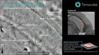 Brain tissue microstructures taken labelfree by the Tomocube HTX1 [upl. by Notxarb]