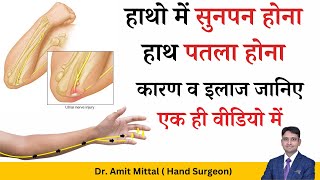 क्यों रहता हैं उंगलियों में सुनपन और हाथ का पतला होना। कारण व इलाज  Nerve Disorders [upl. by Edyth]