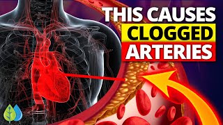 1 Hidden Cause of Clogged Arteries [upl. by Aerdnad]