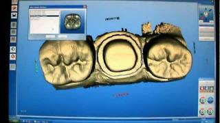 Cerec 3D Crown Master Mode stepbystep [upl. by Asseniv]