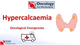 Hypercalcaemia of malignancy [upl. by Veron]