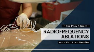 Radiofrequency Ablations What You Should Know [upl. by Anabel665]