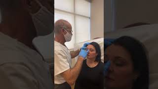 Xeomin Injection for Brow Lift Lip Flip and Tight Jaw [upl. by Fergus]