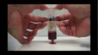 Biologics  PRP  ACP extraction syringe [upl. by Nivaj]