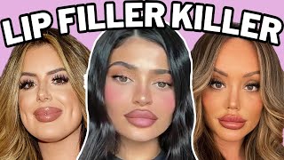 lip fillers will ruin you [upl. by Dugas]