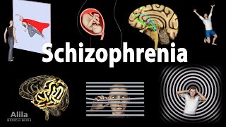 Schizophrenia Symptoms Cause Pathophysiology Diagnosis and Treatments Animation [upl. by Mersey]