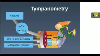 ENT LECTURES  Investigations  TYMPANOMETRY [upl. by Ecnatsnok808]