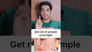 1 रात में pimples हमेशा के लिए गायब☑️  How To Remove Pimples At Home skincare  Ai generated [upl. by Eedolem]