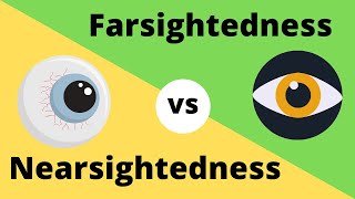 Difference between Myopia  Near Sightedness and Hyperopia  FarSightedness [upl. by Ruddy]