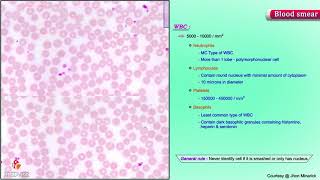 Blood Smear  Shotgun Histology [upl. by Duleba377]