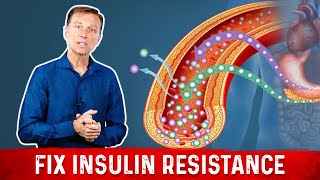 7 Things That Boost Insulin Sensitivity or Reverse Insulin Resistance  Dr Berg [upl. by Hayidah319]