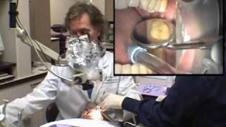 Dr David Clark Modern Version of Sealants Part 1 [upl. by Zoller]