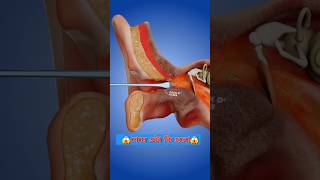 Do not clean earwax shorts facts trending [upl. by Leund177]