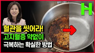 매일 이것만 하면 고지혈증 약 없이 사라집니다 건강한 혈관 만드는 가장 간단한 방법 [upl. by Lorine]