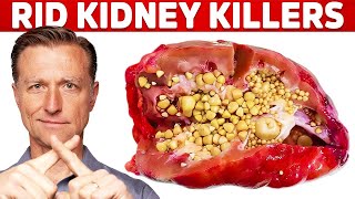 Clean Your Kidneys of Uric Acid and Oxalates [upl. by Maloney784]