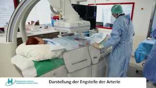 AngiographieAnlage HighEndMedizin im Medizinischen Zentrum Städteregion Aachen [upl. by Angrist986]