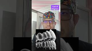 Cost of Aligners  What are Aligners  Briefly explained smile viralvideo youtubeshorts [upl. by Ikkin]