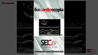 Curso de Ecocardioscopia Ecocardiografía básica [upl. by Cooperman]