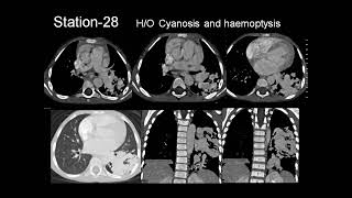 RADIOLOGY EXAM CASES [upl. by Asiek]