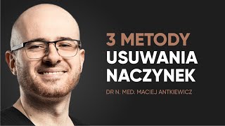 Usuwanie pajączków na nogach – jakie metody są stosowane [upl. by Valdemar]