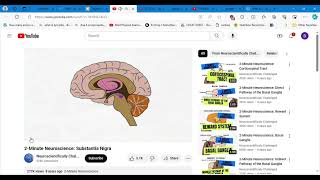 CONCEPTS OF CARE FOR PTS WITH CONDITIONS OF CNS THE BRAIN PARKINSON 1 [upl. by Blasien]