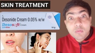 desosoft cream use in hindi [upl. by Ietta]