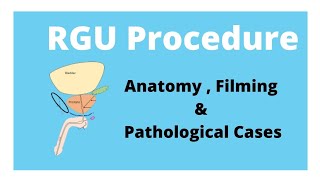 RGU Procedure Anatomy  filming and Pathological cases [upl. by Hillman]