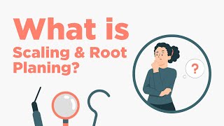 Scaling amp Root Planing  Everything You Need to Know [upl. by Apur]