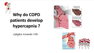 Why does COPD cause hypercapnia [upl. by Kire940]