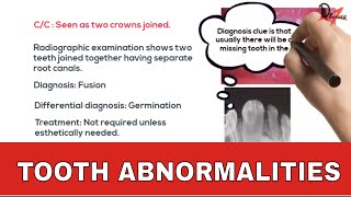 Tooth Abnormalities Some alterations in size [upl. by Solraced]