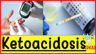 ketoacidosisdiabetes ketoacidosis signs and symptoms Diagnosis [upl. by Ataliah]